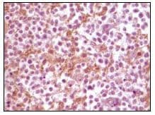 SNCA / Alpha-Synuclein Antibody (clone 2B2D1, 2B2A11)