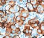 Monoclonal Mouse anti-Human CA125 Antibody (clone OC125, Ready-to-Use, IHC)