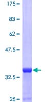 Human Neuropeptide Y / NPY Protein (Recombinant GST)