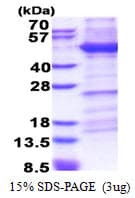Human ITGB1 / Integrin Beta 1 / CD29 Protein (Recombinant His)