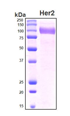 Human ERBB2 / HER2 Protein (Recombinant 6His, N-terminus)