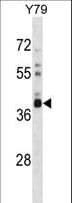 OR52L1 Antibody (aa300-329)