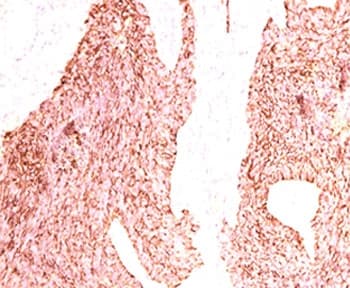 CHGA / Chromogranin A Antibody (clone LK2H10, Ready-to-Use)