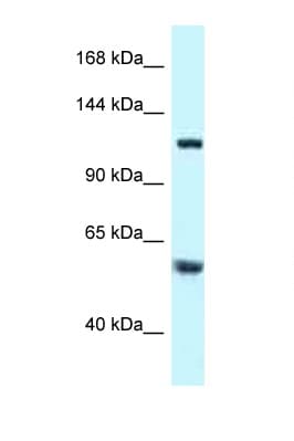 TBCD Antibody (aa299-348)