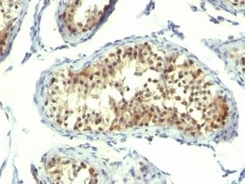 TS / Thymidylate Synthase Antibody (clone TMS715, Ready-to-Use)
