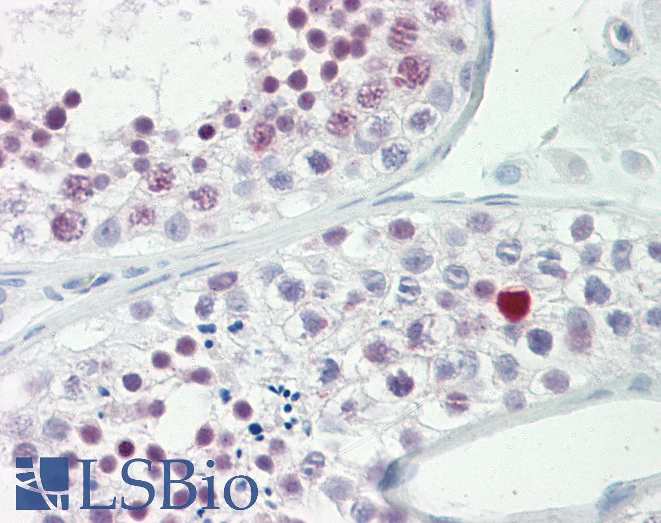 IHC-plus™ BRMS1 Antibody (aa21-70)