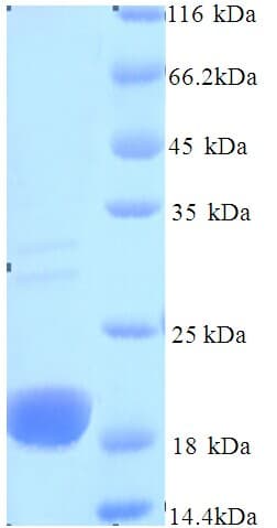 Cytomegalovirus gH / Envelope Glycoprotein H (Recombinant His)