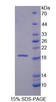 Mouse IL3 Protein (Recombinant His-T7, N-terminus)