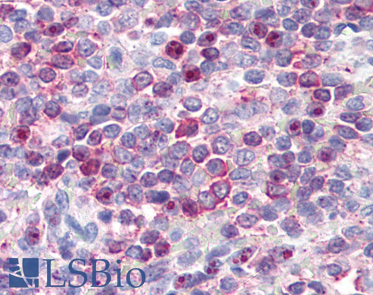 IHC-plus™ Polyclonal Rabbit anti-Human Leukotriene B4 Receptor / BLT1 Antibody (Cytoplasmic Domain, IHC)