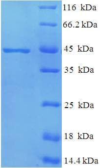 Mycobacterium tuberculosis MPT51/MPB51 Antigen Protein (Recombinant His-SUMO)