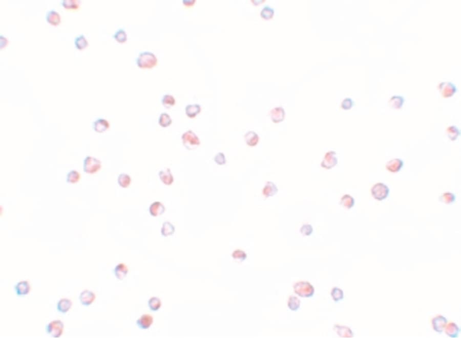 ZRP-1 / TRIP6 Antibody