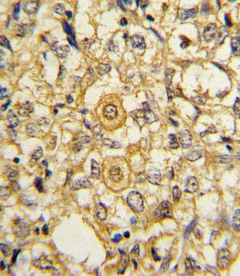 PDGFRB / PDGFR Beta Antibody (aa40-72)