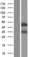 Human RBM41 Protein (Over-Expression Lysate Myc-DDK (Flag))