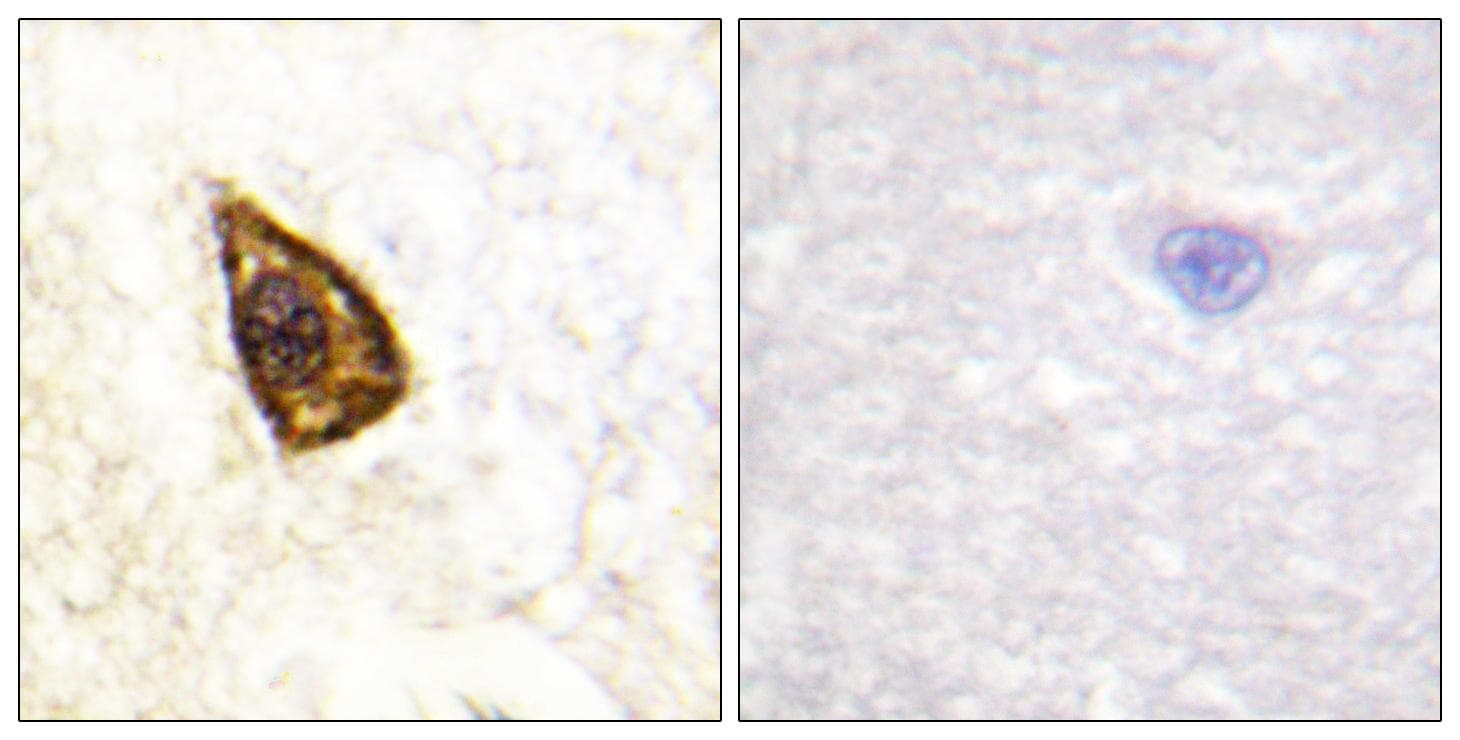 NTRK2 / TRKB Antibody (Ab-705)