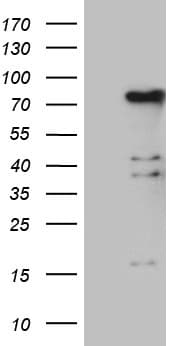 ELL / MEN Antibody (aa302-621, clone OTI3E9)