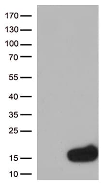 CSTB / Cystatin B / Stefin B Antibody (aa1-98, clone OTI1F12)