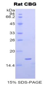 Rat SERPINA6 / CBG Protein (Recombinant His)
