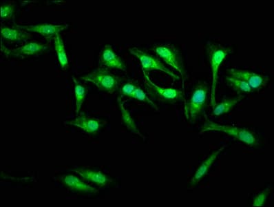 Polyclonal Rabbit anti-Human SSH3 Antibody (IHC, IF, WB)
