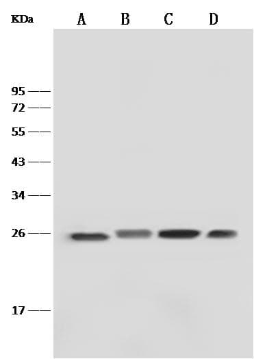 Monoclonal Rabbit anti-Human GSTP1 / GST Pi Antibody (clone 028, Preservative Free, WB)