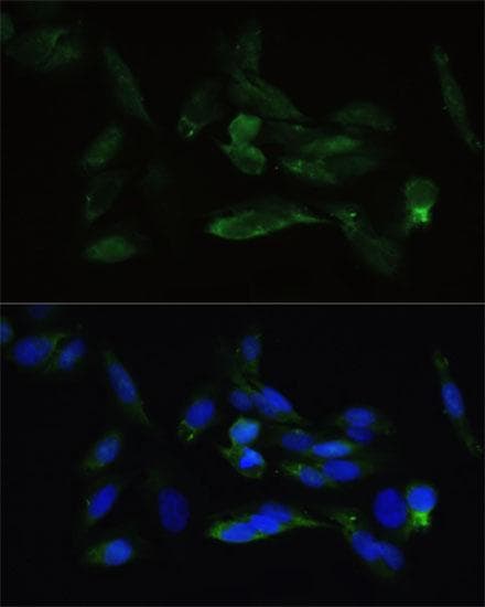 Polyclonal Rabbit anti-Human TGFBR2 Antibody (IHC, IF)