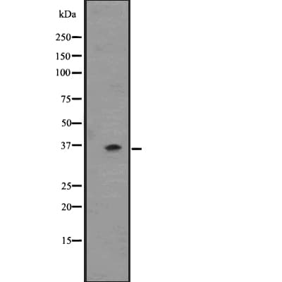 OR2T6 Antibody