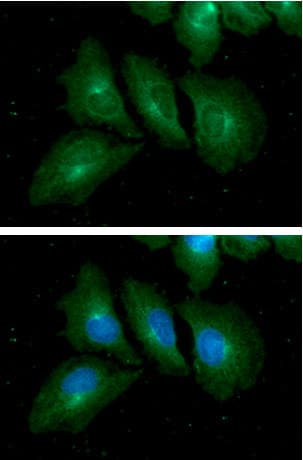 Monoclonal Mouse anti-Human RAB7A / RAB7 Antibody (clone AT10E4, WB)