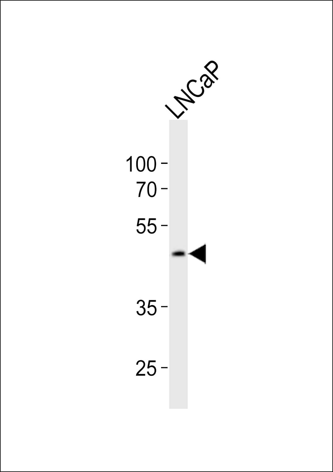 SOX17 Antibody (aa376-409)