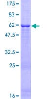 Human WDR83 Protein (Recombinant GST)