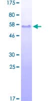 Human Band 4.1 / EPB41 Protein (Recombinant GST, N-terminus)