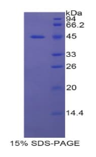 Rat UCP1 / UCP-1 Protein (Recombinant His-GST)