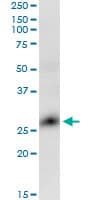 GLIPR1 / GLIPR Antibody (clone 8D9)