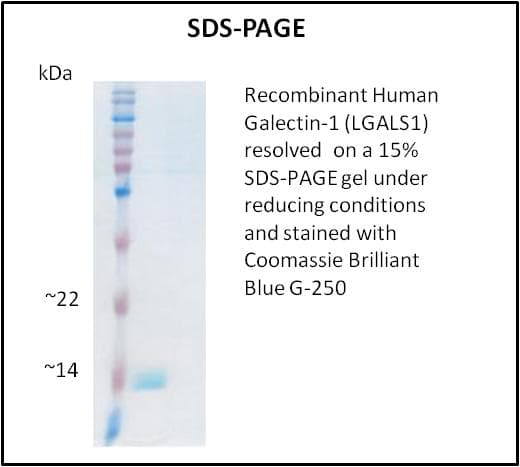 Human LGALS1 / Galectin 1 Protein (Recombinant)