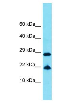 FAM25E Antibody (aa93-142)