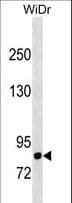 DPP4 / CD26 Antibody (aa46-74)