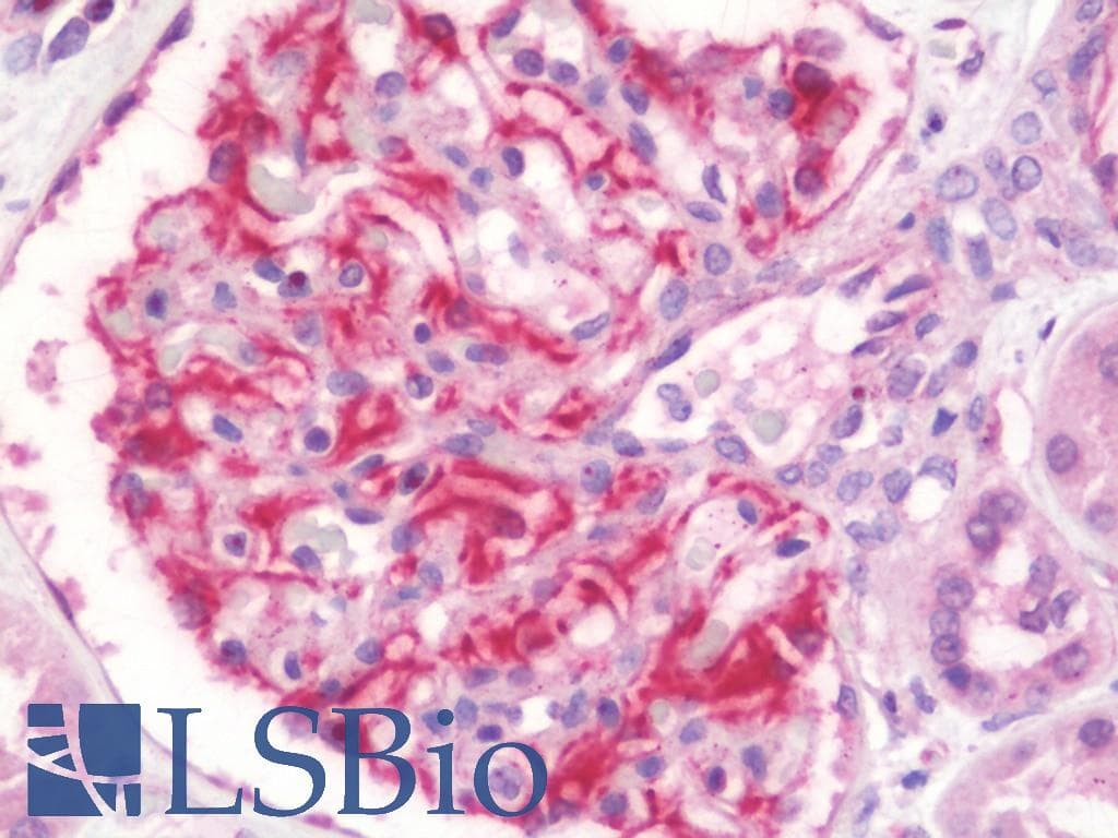 IHC-plus™ TDP2 / TTRAP Antibody