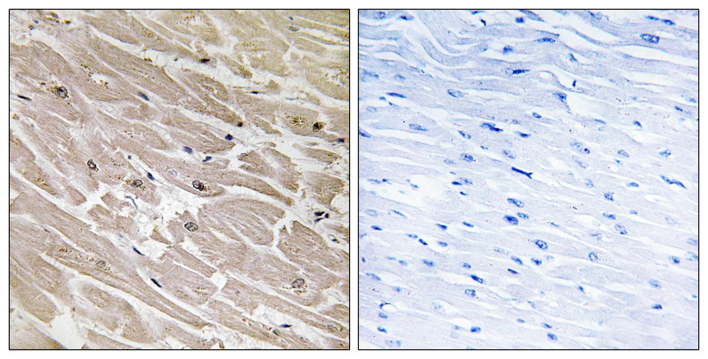 MRPL46 Antibody