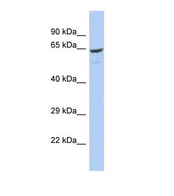FBXO21 Antibody (C-Terminus)