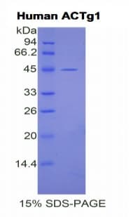 Human ACTG1 / Gamma Actin Protein (Recombinant His)