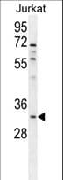 OR5B12 Antibody (aa278-307)