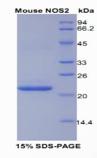 Mouse NOS2 / iNOS Protein (Recombinant His)