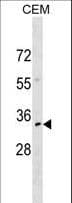 NKX2-6 Antibody (aa14-42)