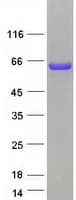 Human RAD23B / HR23B Protein (Recombinant Myc-DDK (Flag))