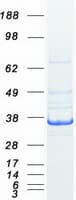 Human LDHC / Lactate Dehydrogenase C Protein (Recombinant Myc-DDK (Flag))