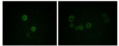 Monoclonal Mouse anti-Human APOM / Apolipoprotein M Antibody (clone 8F12C6B8, IF, WB)