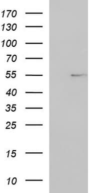 FGG / Fibrinogen Gamma Antibody (clone OTI4G2)