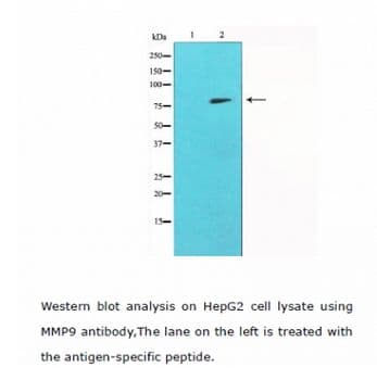 MMP9 / Gelatinase B Antibody