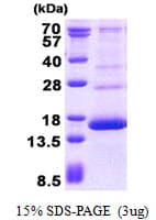 Human HBG2 / Hemoglobin Gamma 2 Protein (Recombinant His)