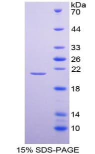 Rat HPSE / Heparanase Protein (Recombinant His-T7)