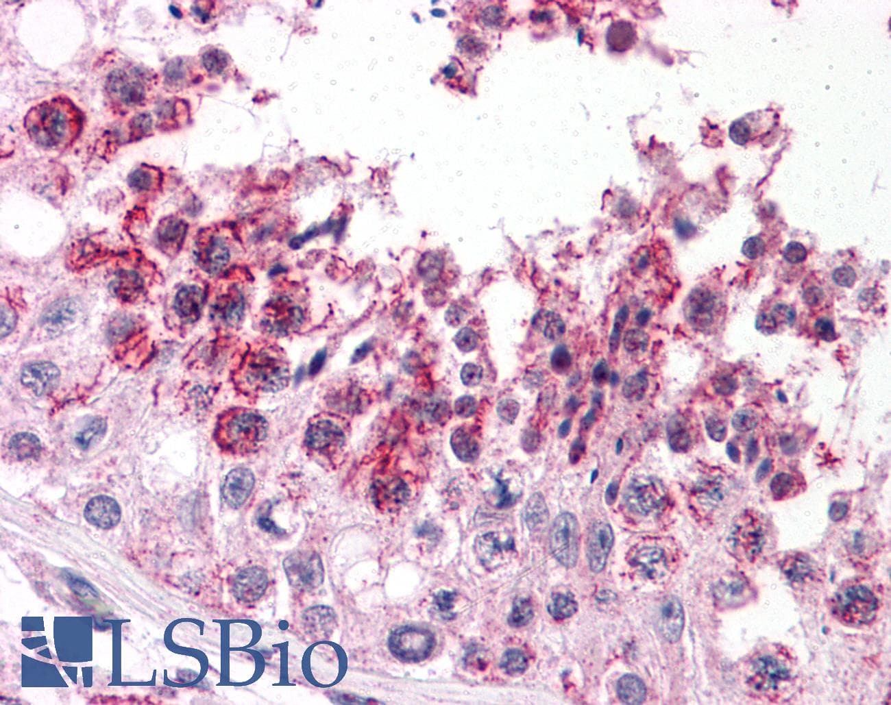 IHC-plus™ SLAIN2 Antibody