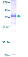 Human IVD Protein (Recombinant GST)